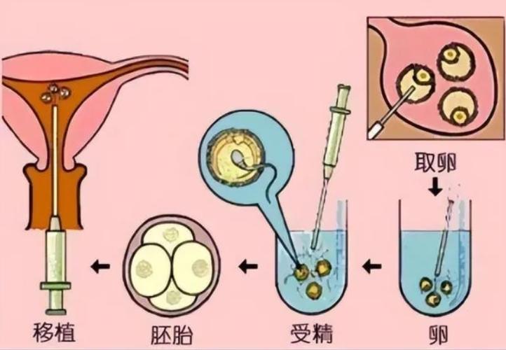 深圳找人供卵试管代生宝宝_深圳寻找供卵试管代生宝宝的机会